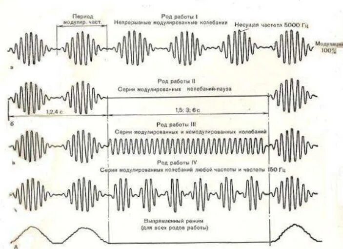 Род частота тока. Амплипульстерапия график тока. Частота синусоидальных модулированных токов. Синусоидальные модулированные токи методика проведения. Синусоидальные токи амплипульс аппарат.