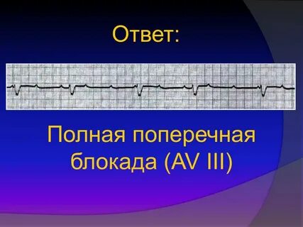 Блокада болезнь