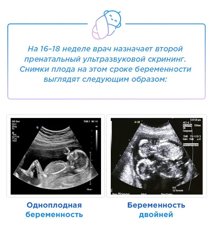 Задания 18 недели. Как выглядит плод на УЗИ В 16 недель. Плод 16 недель беременности размер плода. Размер эмбриона 16 недель. Малыш на 16 неделе беременности УЗИ.