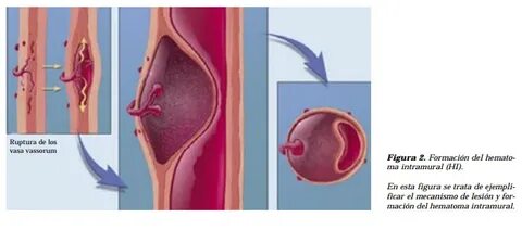 Hunter x Hunter порно комикстері