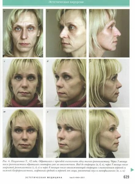 мошак пластический хирург отзывы. пластическая хирургия владивосток. пластическая хирургия владивосток. мошак пластический хирург отзывы. пластэк хирургия владивосток.