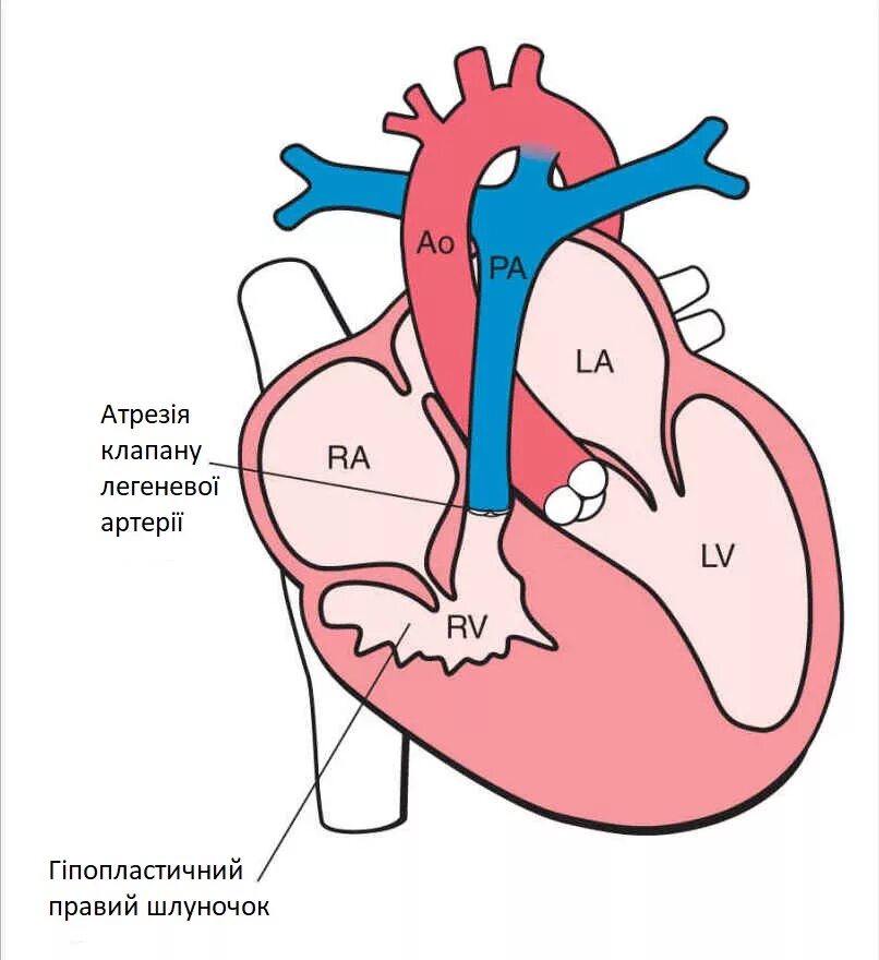 Команда впс. Команда впс. Команда впс. Впс недостаточность кровообращения. Команда впс.