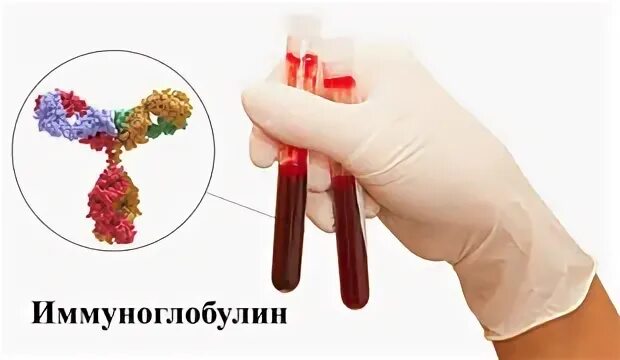 Иммуноглобулин завышен у ребенка