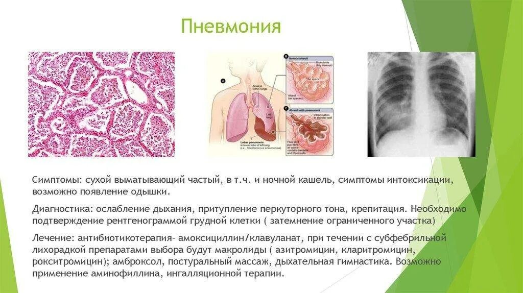 При воспалении легких есть температура