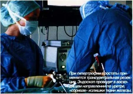 Простата операция восстановление