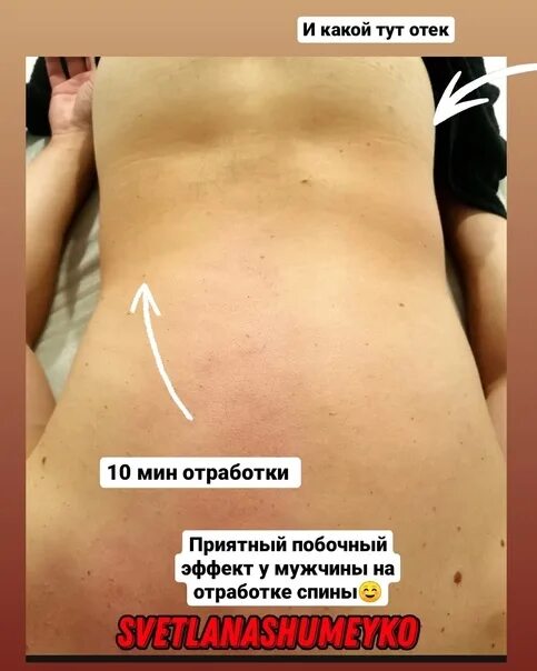 Как выглядит жир на руках Как сжечь висцеральный жир Wonder woman, Superhero, Sport