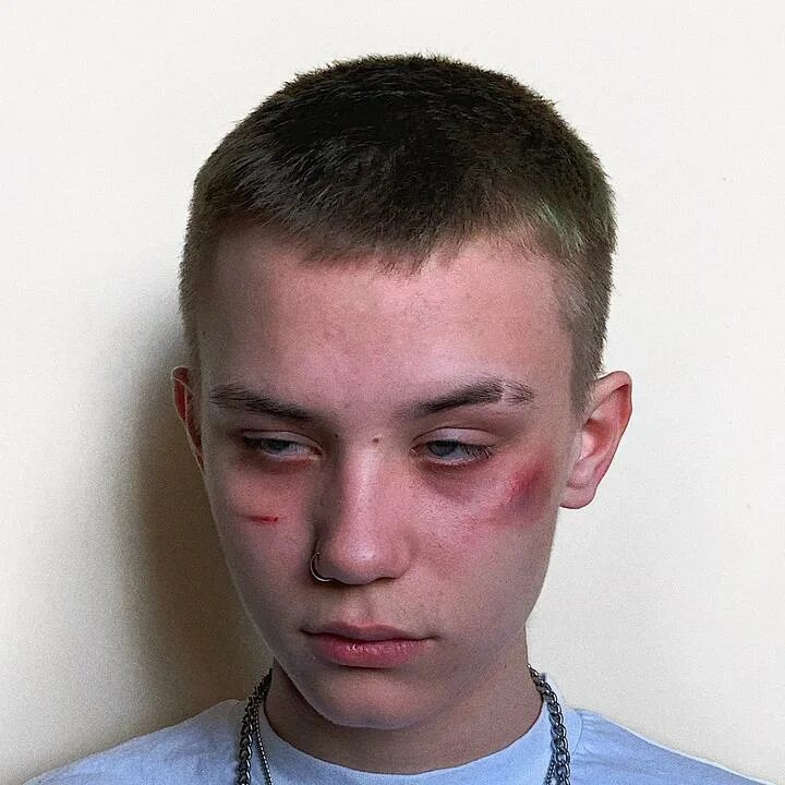 Мякишев синяков