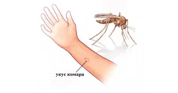 Почему чешется комариный