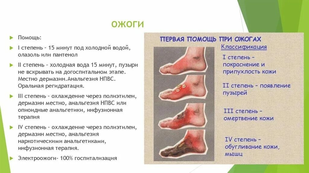 Опасными для жизни ожогами являются. Ожог 1 степени и 2 степени. Ожог 1 степени степень тяжести. Ожоги 2 и 3 степени тяжести.