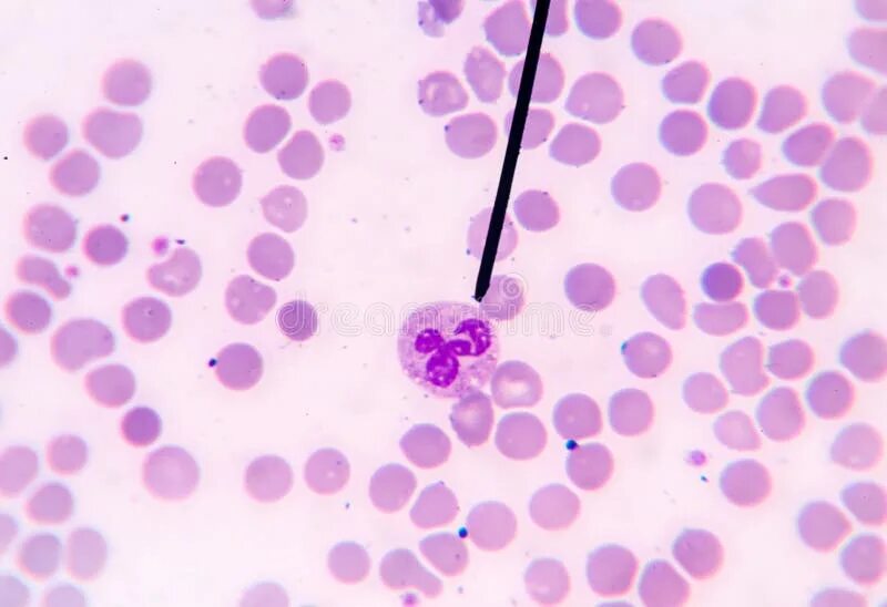 Мазок крови при выявлении патологии что это. Микроскопия мазков крови Ветеринария. Микроскопия окрашенных мазков крови. Дирофиляриоз мазки крови. Микроскопия нативного мазка крови.