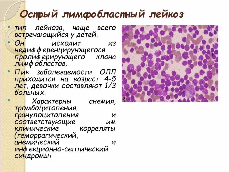 Острый лейкоз сколько живут