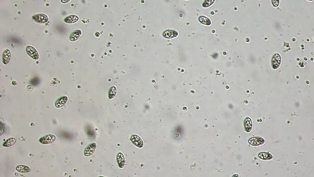 Бактерии пресной воды. Вода под микроскопом. Микроорганизмы в капле воды. Микроорганизмы в воде под микроскопом. Бактерии в воде под микроскопом.