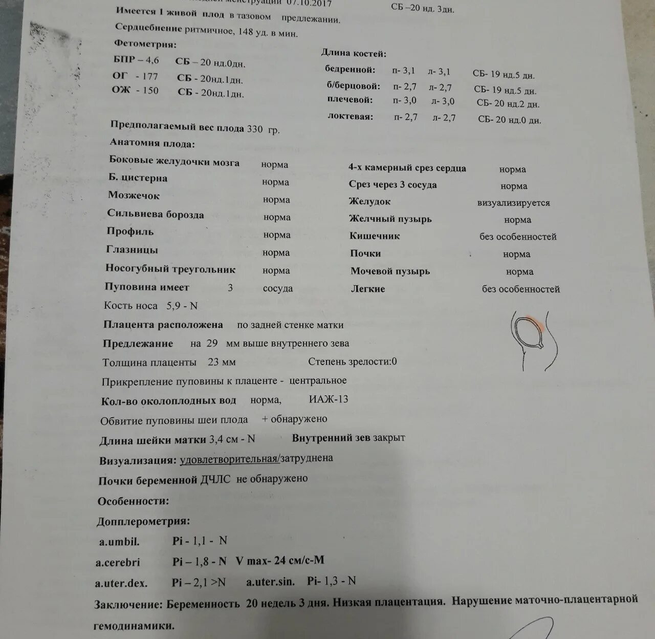 Цир анализы. 2 скрининг цир. 2 скрининг нормы показателей узи. низкая плацентация заключение узи. плохой второй скрининг форум.