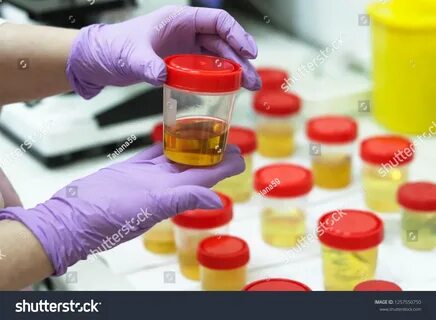25.872 Urine testing Görseli, Stok Fotoğraflar ve Vektörler Shutterstock