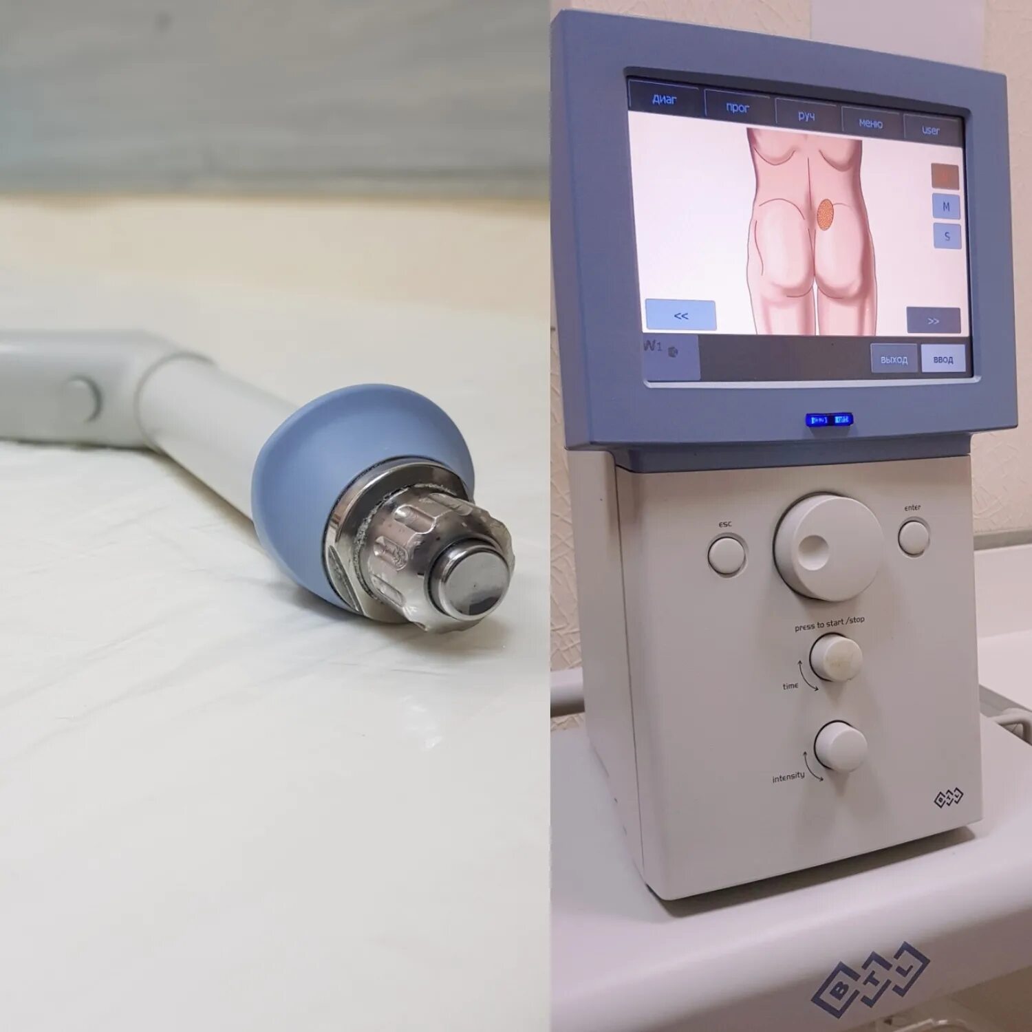 ударно-волновой аппарат для домашнего пользования. прибор увт-2. аппарат ударно-волновой терапии btl-6000 swt. аппарат увт (ударно-волновой терапии). увт btl 6000.