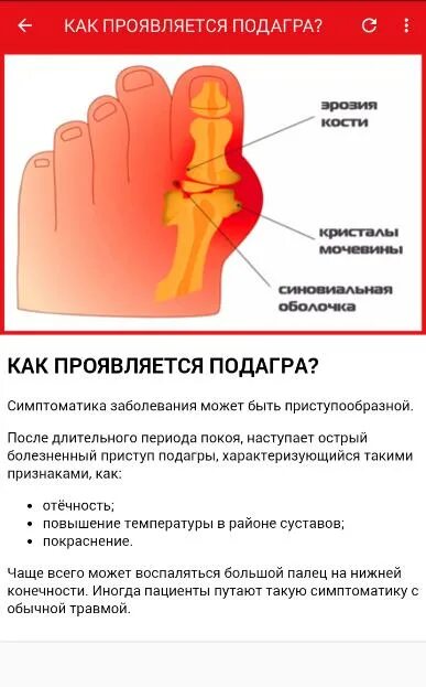 К какому врачу идти с подагрой
