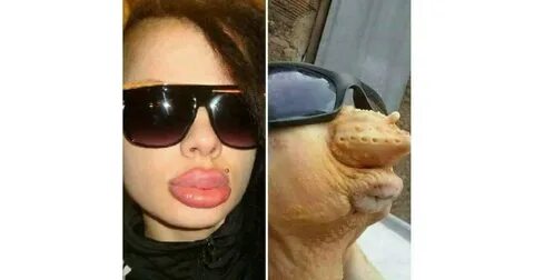 Накаченные губы прикол
