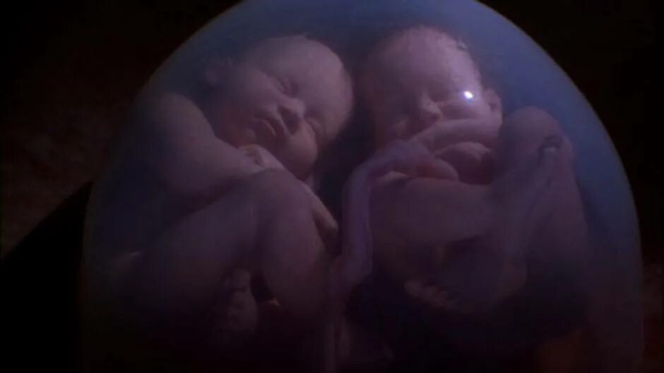 Видео 3 недели. Многоплодная беременность в утробе. Однояйцевые Близнецы в утробе. Многоплодная беременность рождение малышей. Ребёнок в утробе матери на 35 неделе беременности.