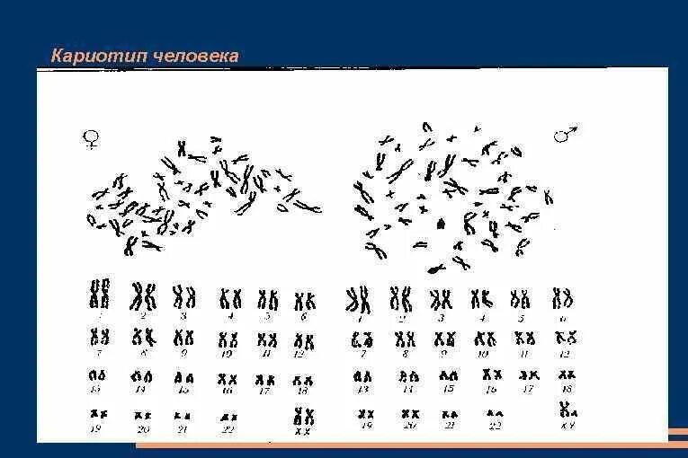 Как выглядит кариотип. Нормальный кариотип человека рисунок. хромосомный набор кариотип человека рисунок. кариотип здорового человека. кариотип и идиограмма хромосом человека.