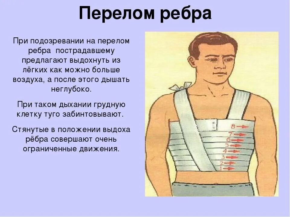 Что делать при переломе ребра