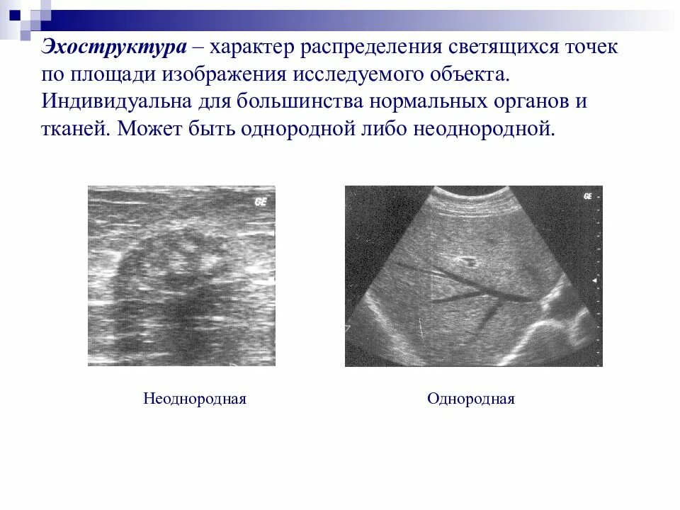 Печень узи форум. Эхоструктура неоднородная селезенка. УЗИ печени эхоструктура однородная среднезернистая. Эхоструктура печени однородная.