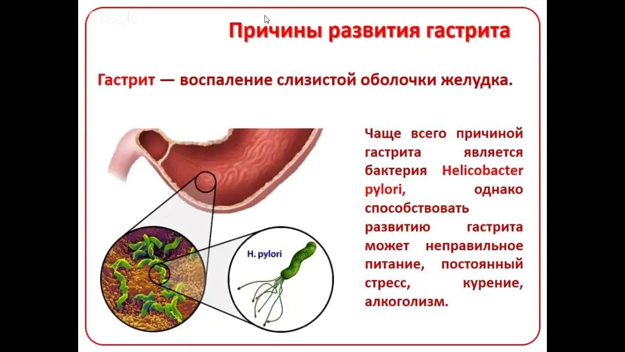 Панкреатит и холецистит. Причины развития гастрита. Желчный пузырь гастрит