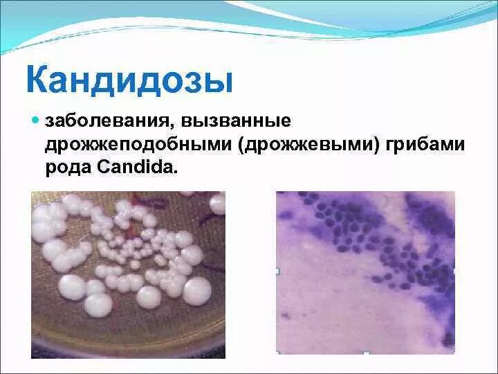 Микроорганизмы вызывающие заболевания называются. Дрожжеподобные грибы кандида микробиология. Грибы рода Candida заболевание. Дрожжи кандида микробиология. Дрожжеподобные грибы рода Candida (молочница)..