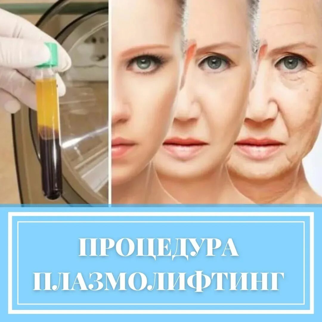 Что такое плазма в косметологии. Показания плазмолифтинга лица. Плазмолифтинг лица протокол процедуры. Плазменный лифтинг лица. Что такое плазма в косметологии.