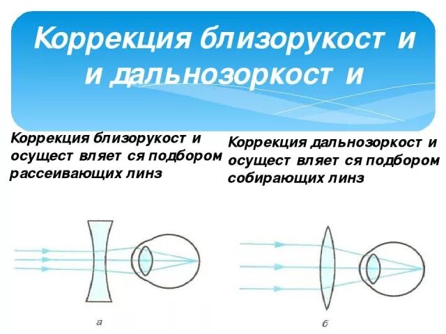 Линзы для исправления близорукости. Коррекция близорукости и дальнозоркости с помощью линз. Что такое близорукость (миопия) и дальнозоркость (гиперметропия). Линзы для коррекции дальнозоркости физика. Оптика линзы физика.