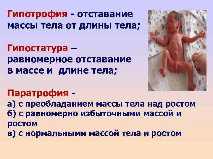 Степени у новорожденных