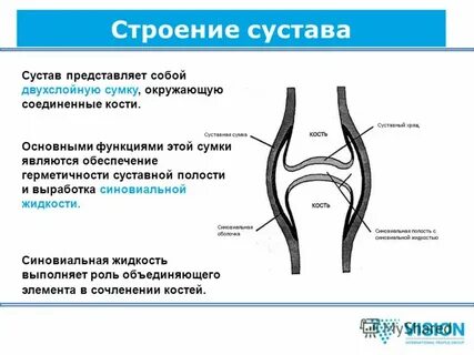 Какие особенности сустава делают его прочным