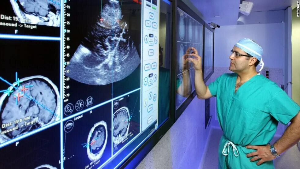 Врач по сосудам головы. Ишемический инсульт головного мозга. Невролог и пациент. Врач лечит сосуды головы. Уздг сосудов головы и шеи.