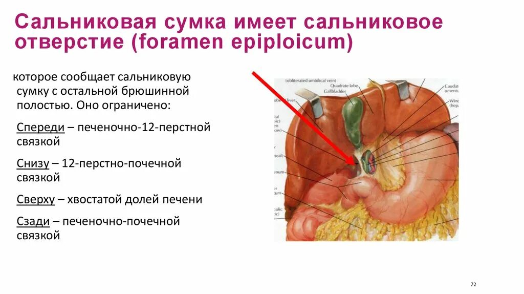 Винслово отверстие. Сальниковая сумка брюшины анатомия. Сальниковая сумка и печеночная сумка. Сальниковая сумка поджелудочной железы. Оперативные доступы в сальниковую сумку.