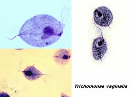 Trichomonas vaginālis