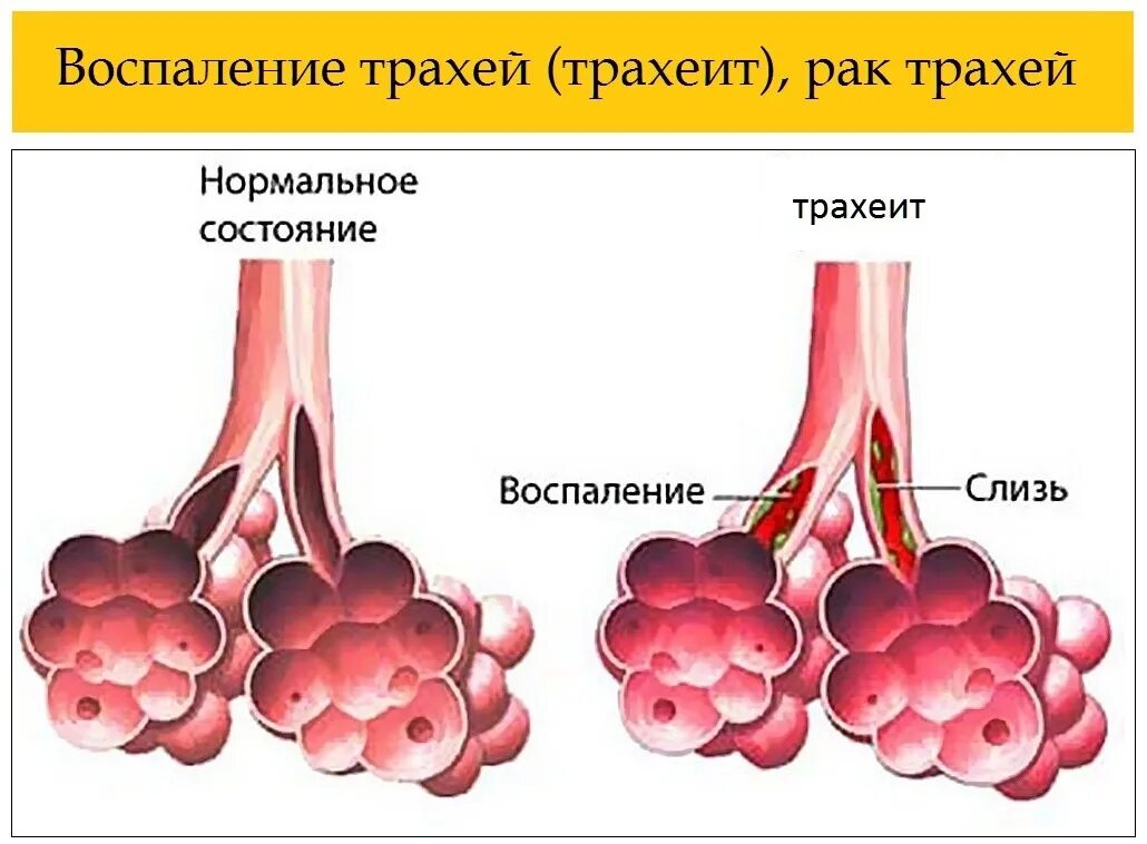 Трахею девушку видео