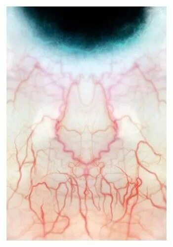 Normal Retinal Anatomy Arteries anatomy, Eye health facts, Anatomy