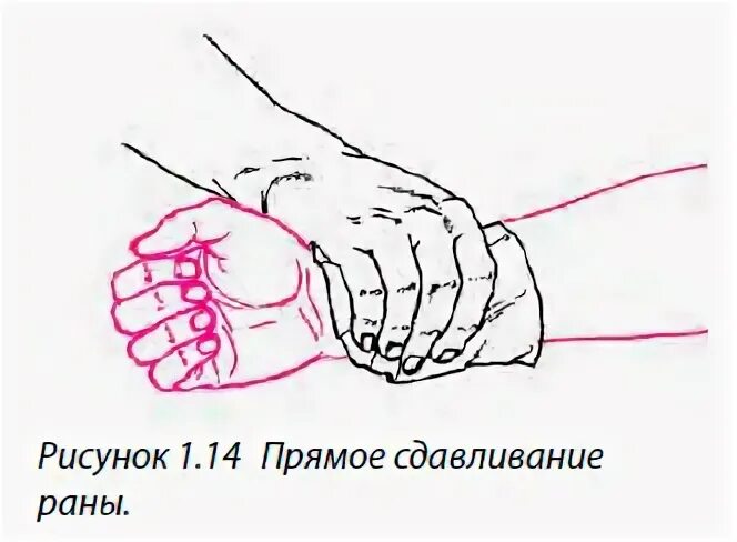 Давление на рану