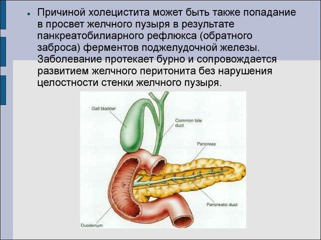 Причины заболевания холецистита. При воспалении желчного пузыря. Основные признаки острого холецистита. Основные причины развития острого холецистита. Схема терапии острого холецистита.