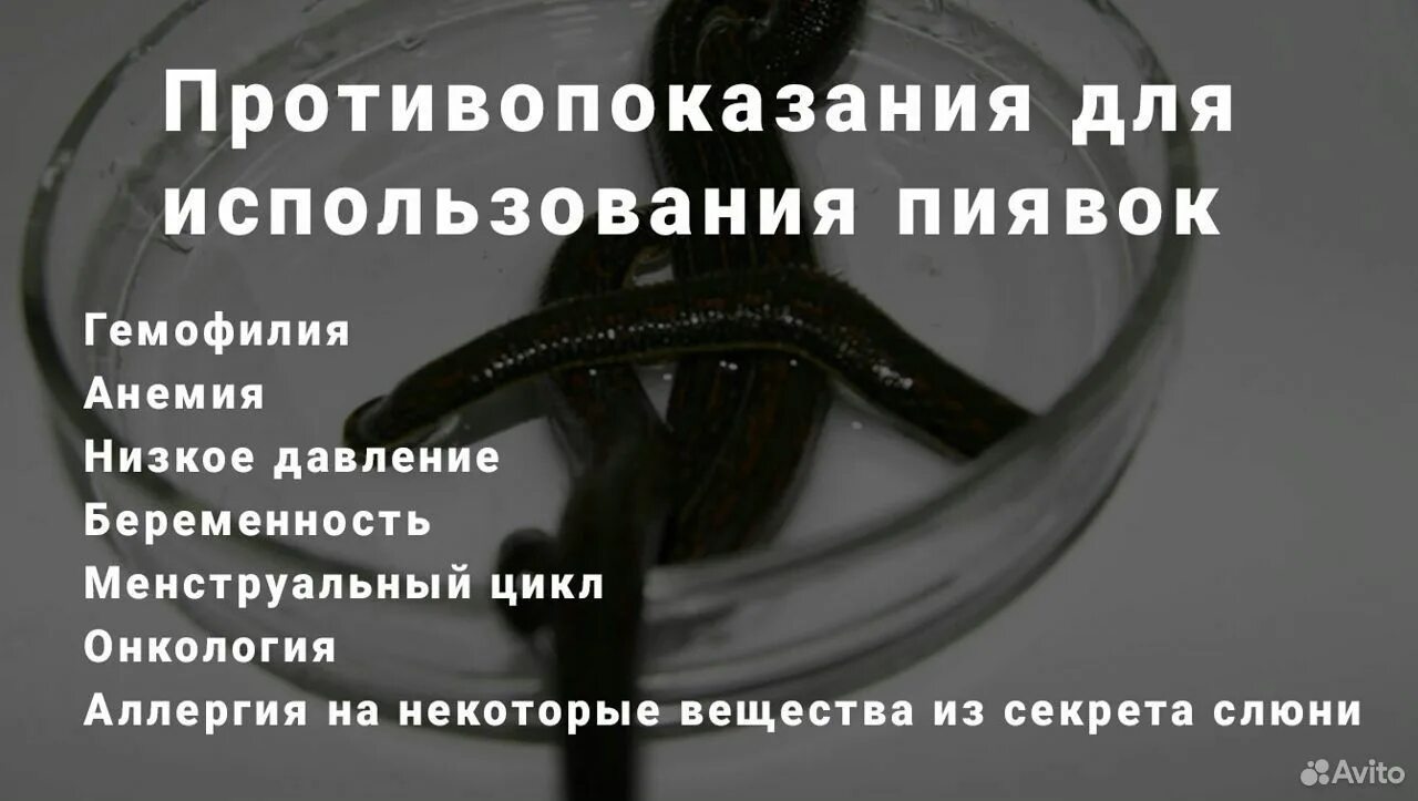 Противопоказания для постановки пиявок. Пиявки противопоказания. Гирудотерапия противопоказания. Показания для постановки пиявок. От каких болезней пиявки