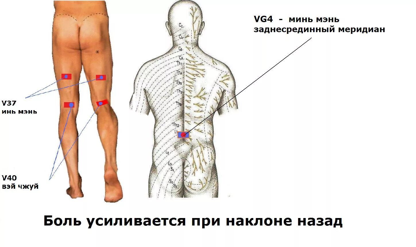 Боль в пояснице. Болит спина в пояснице при наклоне вперед. Болит спина при наклоне. Боль в пояснице при наклонах в стороны.