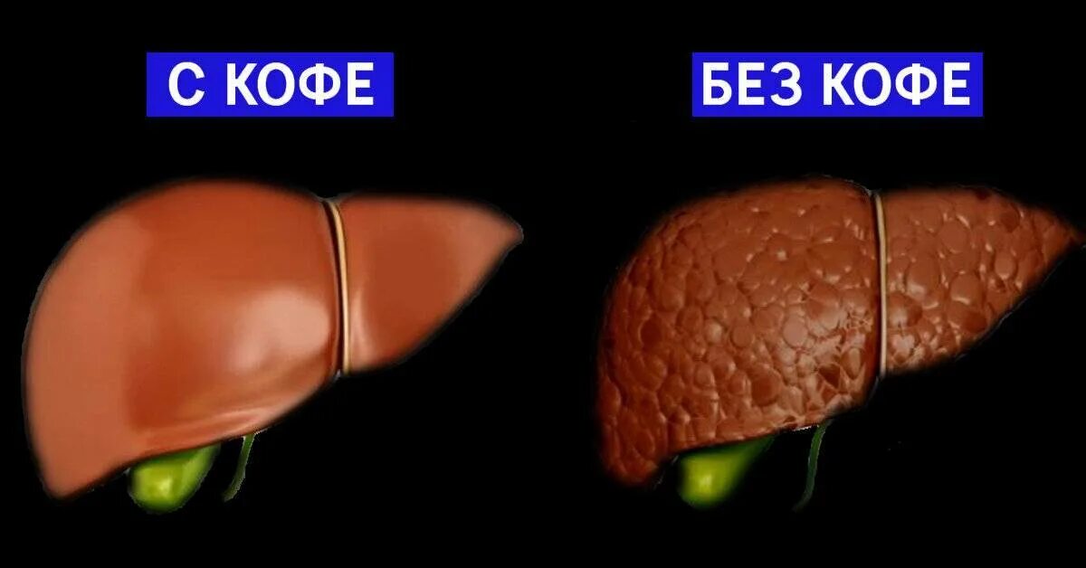 Кофе и печень как влияет. Печень здоровая и больная. Кофе воздействие на печень.