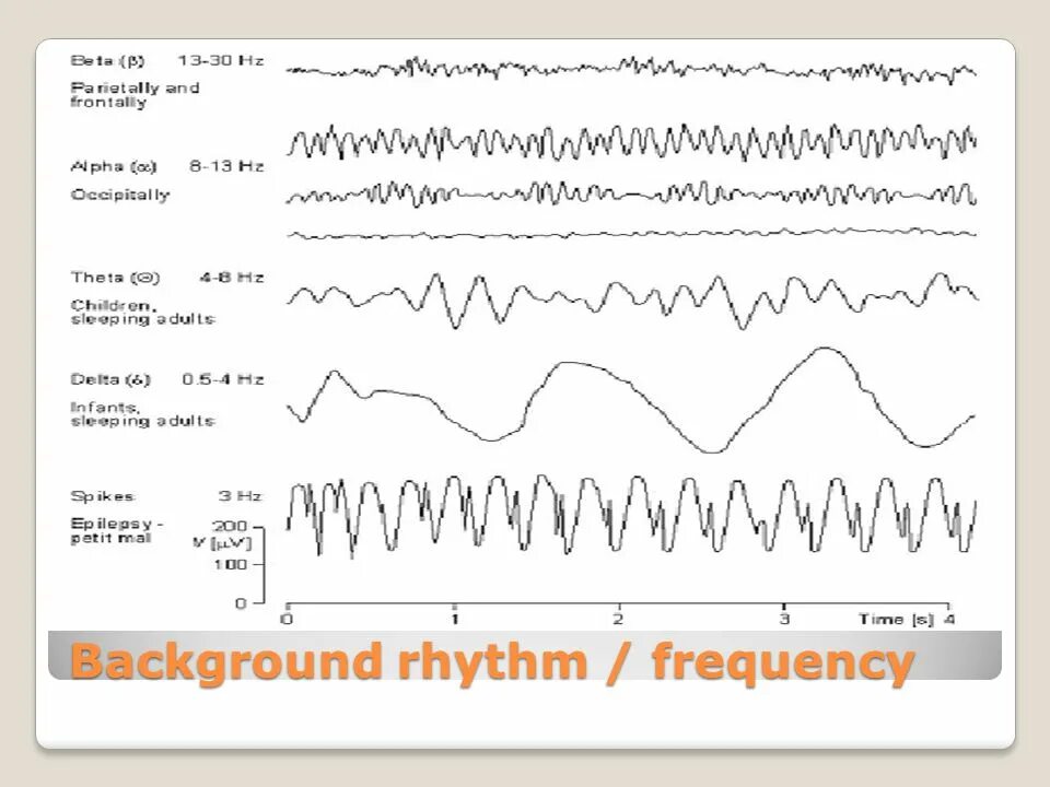 Частота ээг. Частотный диапазон Альфа ритма на ЭЭГ. Альфа ритм ЭЭГ. Альфа и бета ритмы на ЭЭГ. Ритмы ЭЭГ физиология.