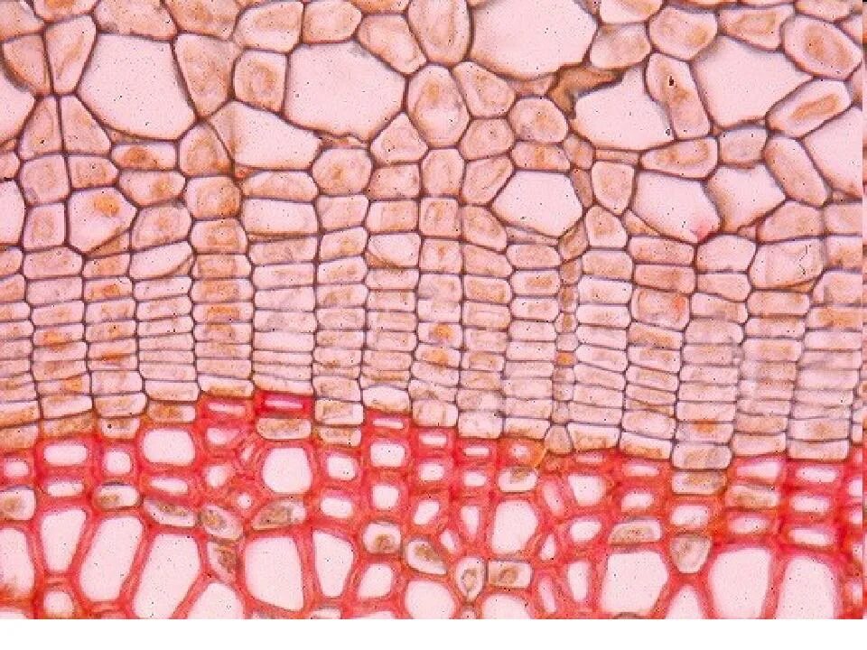 Покровная ткань кожица проводящая ткань впр. Микропрепарат ткани растений. Перидерма с чечевичками. Камбий покровная ткань. Покровные ткани растений перидерма.