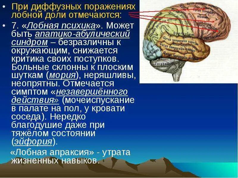 Поражение лобных долей мозга. Поражение лобное доли на мрт. Опухоль лобной доли синдром. Повреждения лобной доли мозга. Синдром поражения лобной доли головного мозга.