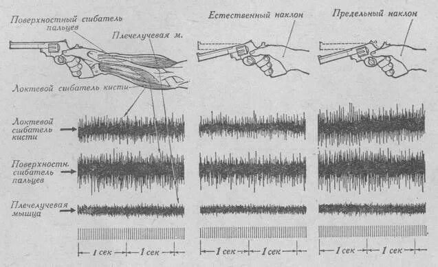 ЭНМГ игольчатая верхних конечностей. Накожная поверхностная электромиография. ЭМГ сигнал. Поверхностная ЭМГ электромиограмма. Норма сжатия кисти