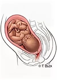 Расположение плода на 38 неделе беременности. Расположение ребенка на 37 неделе. Расположение ребенка в животе. Расположение плода на 37 неделе беременности.