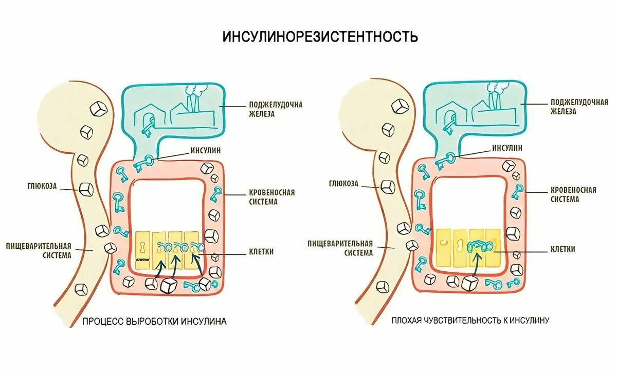 Инсулин ключик инсулинорезистентность. Симптомы инсулин инсулинорезистентность. Резистентность тканей к инсулину. Чувствительность клеток к инсулину при диабете. Голод после инсулина