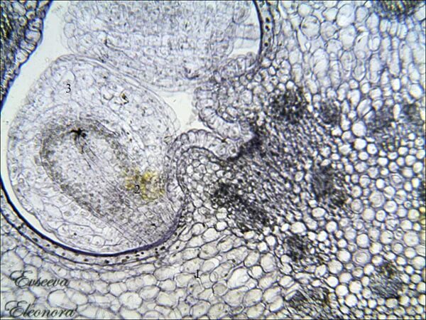Поперечный срез завязи пестика лилии под микроскопом. Поперечный срез завязи микроскоп. Строение завязи микропрепарат. Поперечный срез завязи семяпочки. Поперечный срез завязи под микроскопом.