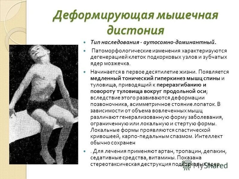 Гистомия