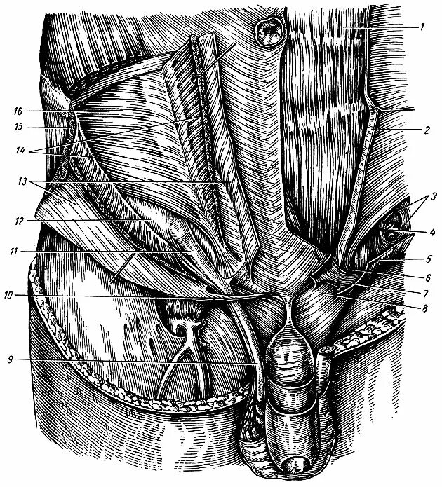 Паховый канатик анатомия. Семенной канатик анатомия мышцы. Семенной канатик топография. Паховая мышца.
